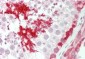 GPI Antibody